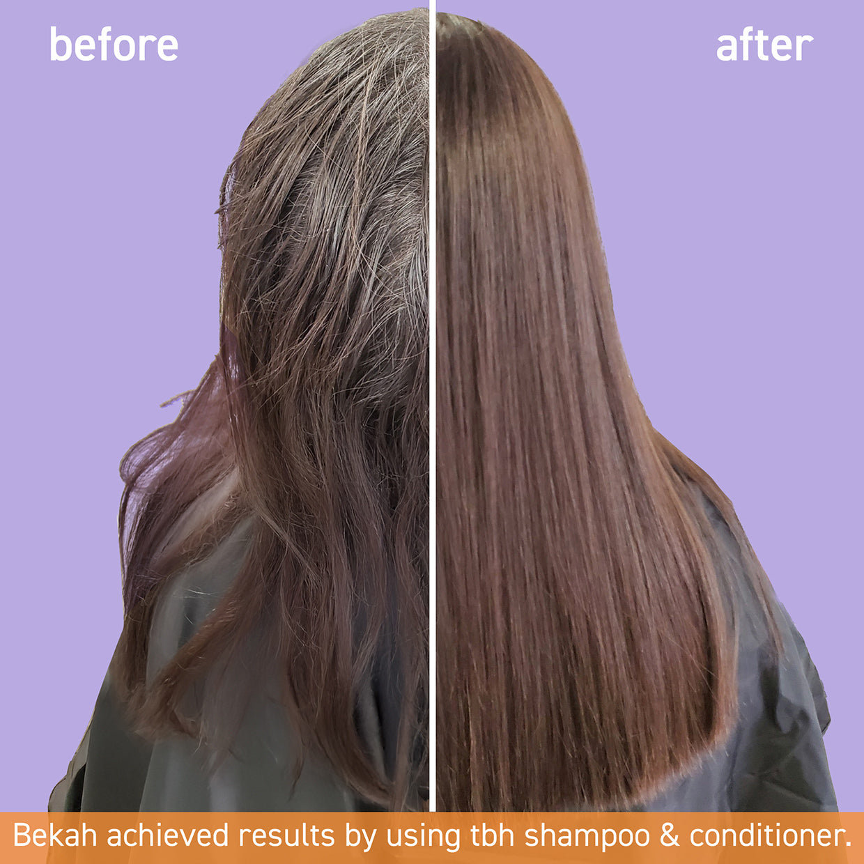 tbh® kids scalp refresh kit